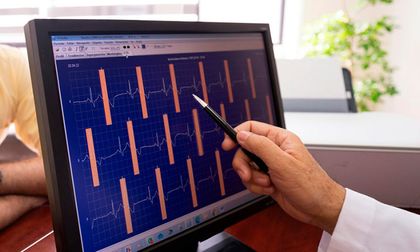 Reparan válvulas mecánicas con catéter sin cirugía abierta