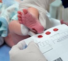 Cada año nacen 8 millones de bebés con anomalías congénitas