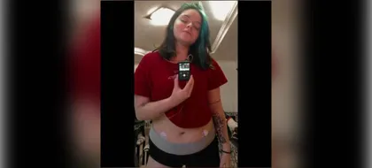 Imagen de Paciente con diabetes suspende bomba de insulina tras 5 meses sin insumos y sin respuesta de Nueva EPS