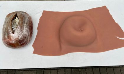 Mujer simuló embarazo para transportar cocaína: nueva táctica del narcotráfico descubierta en Cali