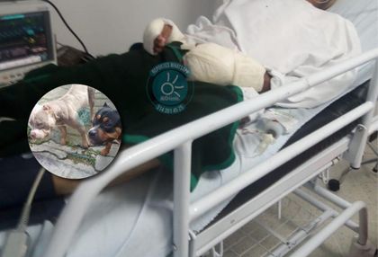 Imagen de Ataque de dos perros dejó a un adulto mayor hospitalizado: esperan que los dueños respondan