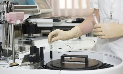 Vea cómo se contagia la viruela del mono