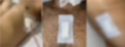 Imagen de  “Estoy vivo de milagro”: delante de sus hijos, un hombre fue apuñalado siete veces por un conductor de Uber