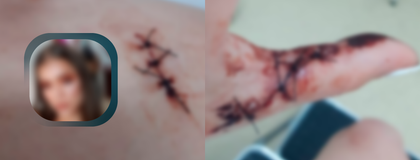 Imagen de Joven fue agredida con arma blanca por su exnovio en San Antonio de Pereira