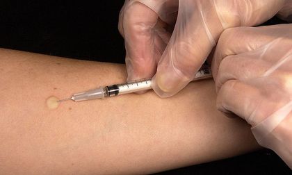 Alerta en el Valle por vacunas homeopáticas