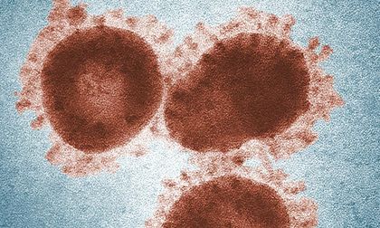 Nuevo virus detectado en China genera preocupación en el país asiático