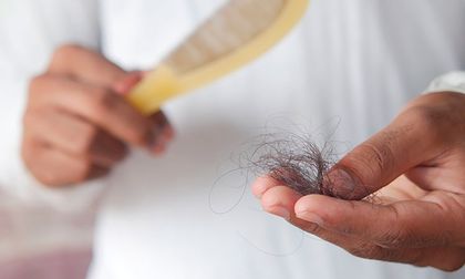 Investigan proteína vinculada a la pérdida de pelo en ratones