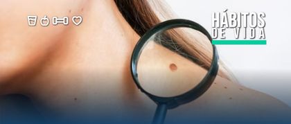 Imagen de  ¿Cómo identificar un lunar cancerígeno?