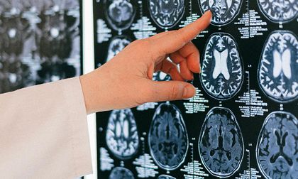 Existe una conexión entre intestino-cerebro y la memoria en la vejez