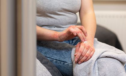 Enfermedades raras en Colombia: 3,5 millones de personas podrían vivir con una