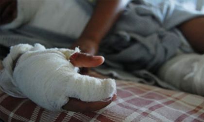 Primer quemado con pólvora en Rionegro: tendrá que pagar un comparendo
