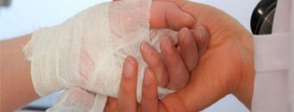 Imagen de  Aumento del 29,5 % de lesionados por pólvora en Antioquia: van 136 casos, 17 en el Oriente