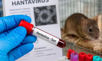 Brote de hantavirus alcanza 12 contagios y mantiene alerta sanitaria