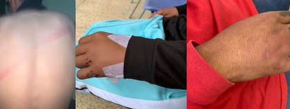 Imagen de  Comunidad de Alto Bonito, Rionegro, denuncia presunto caso de abuso policial en su barrio