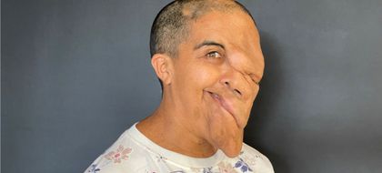 Imagen de Milagros que transforman vidas: exitosa cirugía de Sandra Castañeda, la mujer de Abejorral que encontró esperanza