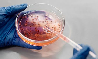 Puntos débiles en enterovirus abren la puerta a antivirales de amplio espectro