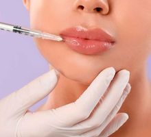 ¿Es seguro aplicarse bótox y tiene beneficios reales?