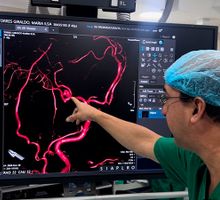 Nuevo angiógrafo de última tecnología en Cali