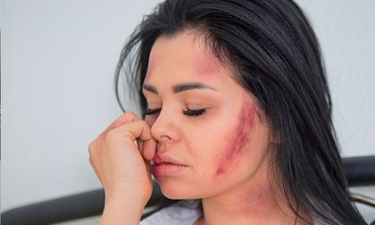 En Cali aumentaron los homicidios contra mujeres y las denuncias por violencia sexual alcanzaron su cifra más alta en cuatro años