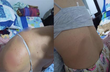 Imagen de Buscan a hombre obsesionado con joven de Marinilla: la atacó 16 veces con arma blanca