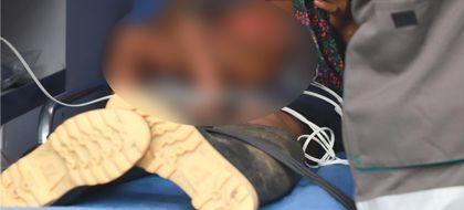 Imagen de  Incendio en comunidad indígena de Urrao dejó una menor fallecida y un menor herido con graves quemaduras