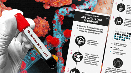 Imagen de  Colombia se acerca a los mil casos confirmados de la viruela del mono
