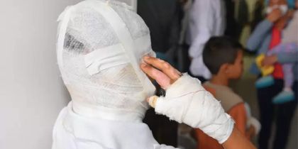 Imagen de Un hombre de 28 años es el primer muerto por pólvora en Colombia