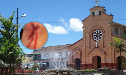 Imagen de Ciclista denuncia que un conductor la arrolló en la vía Concepción-Alejandría